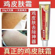 DAGO雞皮膚疙瘩毛囊角化癥專用的藥去角質(zhì)疙瘩大腿手臂去除神器特傚膏