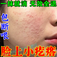 【官方旗艦】臉上起小疙瘩閉口粉刺的克星去除臉部閉合小顆粒脂肪粒逆光疹藥膏 100g