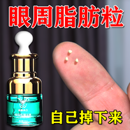 脂肪粒去除藥膏汗管瘤脂肪粒去除神器眼周專用去小顆粒眼霜精華素 一盒裝【體驗(yàn)裝】