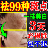 祛斑霜美白淡化老年黃褐雀斑去除黑色素男士醫(yī)用點(diǎn)斑專用正品藥水 特效:買三送二【斑點(diǎn)不留痕 100%祛斑效果最好的產(chǎn)品