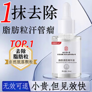 同仁堂脂肪粒去除神器眼部專用去眼部脂肪粒眼袋清肌顆粒眼部精華液30ml