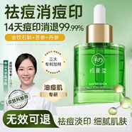 初夏堂金釵石斛祛痘精華液淡化痘印修護痘肌面部祛痘印收縮補水保濕毛孔 祛痘精華液30ml