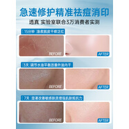 透真 LUCENBASE面霜高保濕修復(fù)肌膚屏障受損舒緩修護保濕滋潤補水正品乳液 150g 急救修護 所有膚質(zhì)