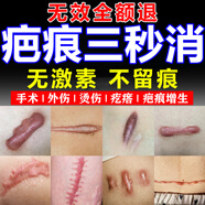 福隆藤原疤克祛疤痕膏手術縫針增生凸起去除疙瘩剖腹產疤痕修復凝膠專醫(yī)用 1盒【日本進口】無激素不留痕 硅酮祛新舊疤痕祛印去黑色素沉淀