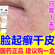 三順 臉干燥起皮瘙癢潤膚秋冬臉粗糙嘴角開(kāi)裂干裂起皮藥膏男女脂溢性皮炎參皇軟膏 5盒【皮膚太干巴】滋潤皮膚