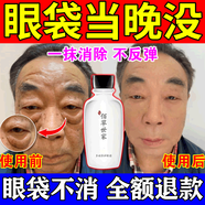 眼袋去除神器男女士專用眼霜葉黃素中老年快速消除嚴(yán)重黑眼圈淡化 買三送二【告別大眼袋】發(fā)五瓶