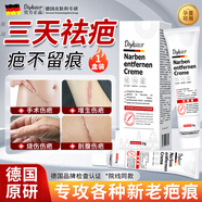 DIYKAUSR祛疤痕專(zhuān)用修復祛疤膏去疤痕凝膠醫用硅酮藥膏兒童燙傷膏疤克增生 傷痕膏疤痕凝膠*1支20g