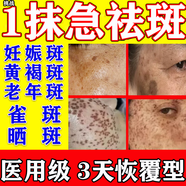 老年斑專(zhuān)用藥一夜消維a酸乳膏去老年斑專(zhuān)用藥去除老年斑特男士效藥老人斑專(zhuān)的用藥膏臉部手背祛斑黑班去斑點(diǎn) 3【長(cháng)年滿(mǎn)臉都是斑不敢出門(mén)】一抹消除不留痕