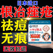 櫻椿焓祛痘消炎痤瘡專用青少年淡化痘印黑色素沉淀精華液藥膏學(xué)生青春痘 3盒【升級款】買2送1 痤瘡專用特效去青春痘粉刺硬疙瘩