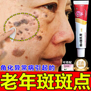 維a酸乳膏0.1角化異常引起老年斑臉部手背祛斑點(diǎn)斑專用OTC藥霜水去老人斑老年斑專用OTC藥一皮夜消 1+1【涂抹+口服】