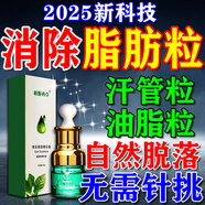 脂肪粒去除藥膏汗管瘤脂肪粒去除神器眼周專用去小顆粒眼霜精華素 買二送一【三盒裝】周期裝