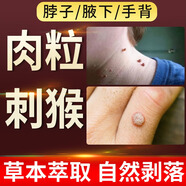 森卓止尤凈跖疣專(zhuān)用非藥腳底趾疣根鴉膽子腳上疣體hpv祛疣非藥膏去除 【肉粒猴子】1盒裝藍色去尤樂(lè )