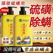 國藥精養硫磺皂除螨沐浴露去螨蟲(chóng)后背痘痘控油雞皮角質(zhì)液皂淋浴400ML*2瓶