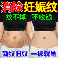 安奈雅妊娠紋修復(fù)霜產(chǎn)后去除消除緊致肚皮淡化生長(zhǎng)紋孕婦預(yù)防專用藥膏油 9盒裝【買5送4】告別小丑妊娠紋