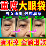 內(nèi)廷上用眼貼膜淡化細(xì)紋去眼袋黑眼圈提拉緊致去除神器消除重度專用女眼袋 買2送1【快速去眼袋】共3盒貼 貼祛眼袋消除重度嚴(yán)重中老年專用