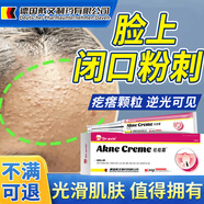 詠幻閉口粉刺臉上起小疙瘩黑頭痤瘡痘痘非藥可搭藥膏克星逆光疹GU 單盒面膜級皮膚油脂分泌過(guò)