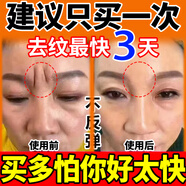 川字紋去除神器填充抬頭紋去除男女重度去皺紋去法令紋貼睡覺(jué)貼膏 8盒【無(wú)效支持退全款】