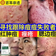 祛痘消炎痤瘡專用青少年護膚品祛除痘印收縮毛孔淡化痘坑痘疤修護 一盒【祛痘專用】