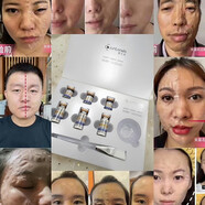 官方直營超聲刀抗皺提拉緊致美容院線雕面膜女巫面具涂抹式魔 美容院線雕