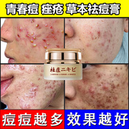 AOPY祛痘膏青春痘粉刺產品霜凝膠貼青少年學生痤瘡痘痘痘坑精華液淡化 痘痘膏兩瓶+原液2+洗面奶1瓶中度