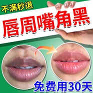嘴唇黑色素去斷嘴角發(fā)黑非改善除色素沉淀唇周黑淡化唇色唇紋嘴唇周圍邊暗沉專用潤唇膏 買3發(fā)5盒【免費(fèi)試用】重度唇周黑