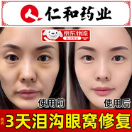 仁和眼窩凹陷修復淚溝去除填充神器去眼睛皮眼袋眼窩松弛膠原蛋白醫(yī)用 眼窩凹陷修復淚溝去除神器 一瓶裝/45ml