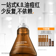 畢生之研五環(huán)精華液3.0-30ml祛痘控油點(diǎn)痘淡紅油橄欖油皮油痘肌修護(hù)女男