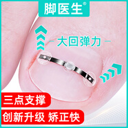 腳醫(yī)生甲溝炎矯正器鎳鈦合金正甲貼片嵌甲專用腳趾甲長(zhǎng)肉里藥監(jiān)備