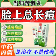 當歸苦參丸北京同仁堂祛痘消炎痤瘡專(zhuān)用青少年臉上長(cháng)痘痘吃什么口服內調治粉刺痤瘡硬疙瘩青春痘去痘的內服藥 5盒裝【青春痘 痤瘡硬疙瘩專(zhuān)用藥】