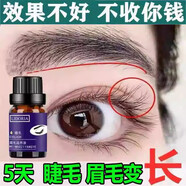 x-doria眼睫毛增長液男女眉毛生長液濃密營養(yǎng)快速滋養(yǎng)精華液 睫毛眉毛都可用 10ml
