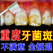喬記本草蛀牙洞補牙齒神器材料永久自己在家補牙洞修復(fù)齲齒填充劑3m醫(yī)用 兒童牙膏6-12歲防蛀除牙菌斑 三盒裝【2盒的錢】