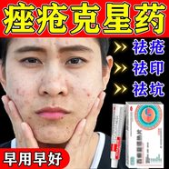 阿達帕林凝膠祛痘藥膏消炎痤瘡專用青少年祛青春痘熬夜上火痘毛囊炎粉刺額頭臉部硬疙瘩消腫去痤瘡痘淡化痘印 【滿臉痤瘡痘用它消炎快速祛除】3+2