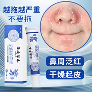 雅萊貝斯鼻子干燥起皮兩側(cè)發(fā)紅脫皮癢鼻翼兩側(cè)泛紅修復(fù)鼻周脂溢性乳膏 #1#