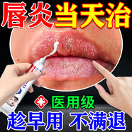 內廷上用唇炎專(zhuān)用醫用級唇炎膏潤唇藥膏慢性嘴唇干裂起皮脫皮兒童成人修復 拍1發(fā)5【高效修復 拒絕干裂出血】常備裝