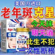 膚研老年斑專用的藥一夜消強(qiáng)力去除手部臉部除斑液祛斑點(diǎn)黑色素專用霜 1盒裝【老年斑克星】美國進(jìn)口 美i白淡化老年黃褐雀斑煙酰胺