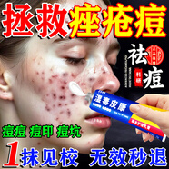 千草本原祛痘淡化痘印藥膏修復(fù)男醫(yī)用青少年青春學(xué)生痤瘡專用硬疙瘩去痘痘 買3送2【告別痤瘡痘】永不長痘