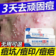 南京同仁堂【強(qiáng)效】額頭上長痘痘頭部粉刺脂肪粒內(nèi)分泌失調(diào)祛痘神器快速消痘 9盒裝【買五送四嚴(yán)重型】
