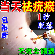 德傳公去疣疣體脫落膏祛疣扁平疣絲狀疣猴子專用袪面部除疣體脖子小肉粒 祛疣液:買3送2【不留疤】 疣清寧疣瘊克皮贅醫(yī)用去除神器