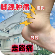 & Other Stories腳踝扭傷腳關節(jié)鼓包腫脹疼痛腳腕腫痛積液腳脖子走路疼專用噴劑藥 1盒 L