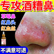 酒糟鼻精華液草莓鼻紅腫玫瑰痤瘡紅鼻子專用去粉刺黑頭紅血絲螨蟲(chóng) 1瓶試用裝【輕微酒糟鼻】