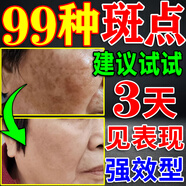 祛斑霜美白淡化老年黃褐雀斑去除黑色素男士醫(yī)用點斑專用正品藥水 一夜消【一支裝曬斑女士用的 100%祛斑效果最好的產(chǎn)品
