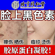 炎癥后臉上黑斑點黑色素可搭去除臉部排毒排黑色素黑色素沉淀面部去斑去黑色素臉部醫(yī)用色素下暗沉膏使用N3 3盒 白愈康膏送棉簽【買2送1】大面積黑色素沉淀