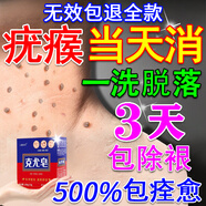 人都本草去疣皂去尤除脖子腋下全身小肉?？损嗳ヰ嘞阍肀馄浇z狀i疣祛i疣瘊 三盒裝【99%中度顧客選擇】 去疣香皂醫(yī)用