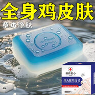 L0【草本皂】去全身雞皮膚疙瘩毛囊角質(zhì)腿部魚(yú)鱗蛇皮滋潤手工皂 買(mǎi)2送1【緩解輕度雞皮】