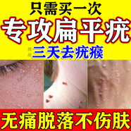 維a酸乳膏去疣醫(yī)用去疣膏去疣專用藥扁平疣專用疣體脫落膏一抹靈去脖子上的小肉粒軟膏去疣靈絲狀疣面部藥 打6折【七盒愈康裝】 裉冶扁平疣 不反覆 【國(guó)藥準(zhǔn)字】特新效期