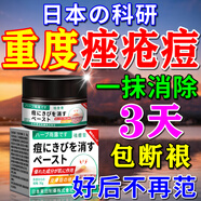 香草雨露痘痘祛痘消炎痤瘡專用修復痘印淡化青少年閉口粉刺臉上硬疙瘩藥膏 買二送一【閉口粉刺】日本特效膏