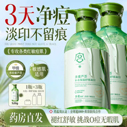 凈麗顏潔面蘆薈膠曬后修復(fù)乳液皮膚補(bǔ)水保濕學(xué)生祛痘縮毛孔淡印舒緩潤(rùn)膚