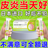 山本中村制薬濕疹藥膏進(jìn)口皮膚瘙癢皮炎濕疹皮癬真菌感染止癢藥膏神經(jīng)過敏性皮炎專用膏藥頭頑固藥皮脂溢脂性皮炎臉上皮膚用膏藥皮炎濕疹真菌王 買2送1【皮炎瘙癢撓不?！?20g 3支 專用特效快