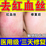 紅血絲修復角質(zhì)層薄皮膚屏障受損泛紅去紅血絲大紅臉正品面部紅血絲修復去除醫用臉上過(guò)敏發(fā)紅癢起維A酸乳膏 1盒【臉上過(guò)敏發(fā)紅臉癢】修復皮膚屏障