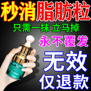 脂肪粒去除藥膏眼部專(zhuān)用神器去眼周小顆粒油脂粒眼霜消汗管瘤克星 拍1發(fā)3盒【滴滴有效】